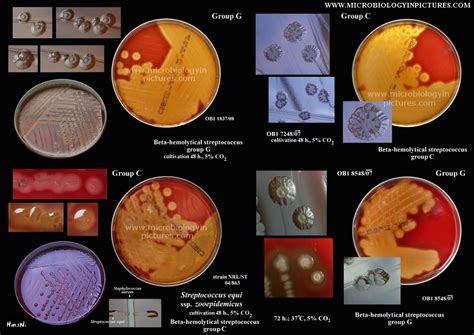 beta strep gp a culture|Streptococcus (Group A) Culture .